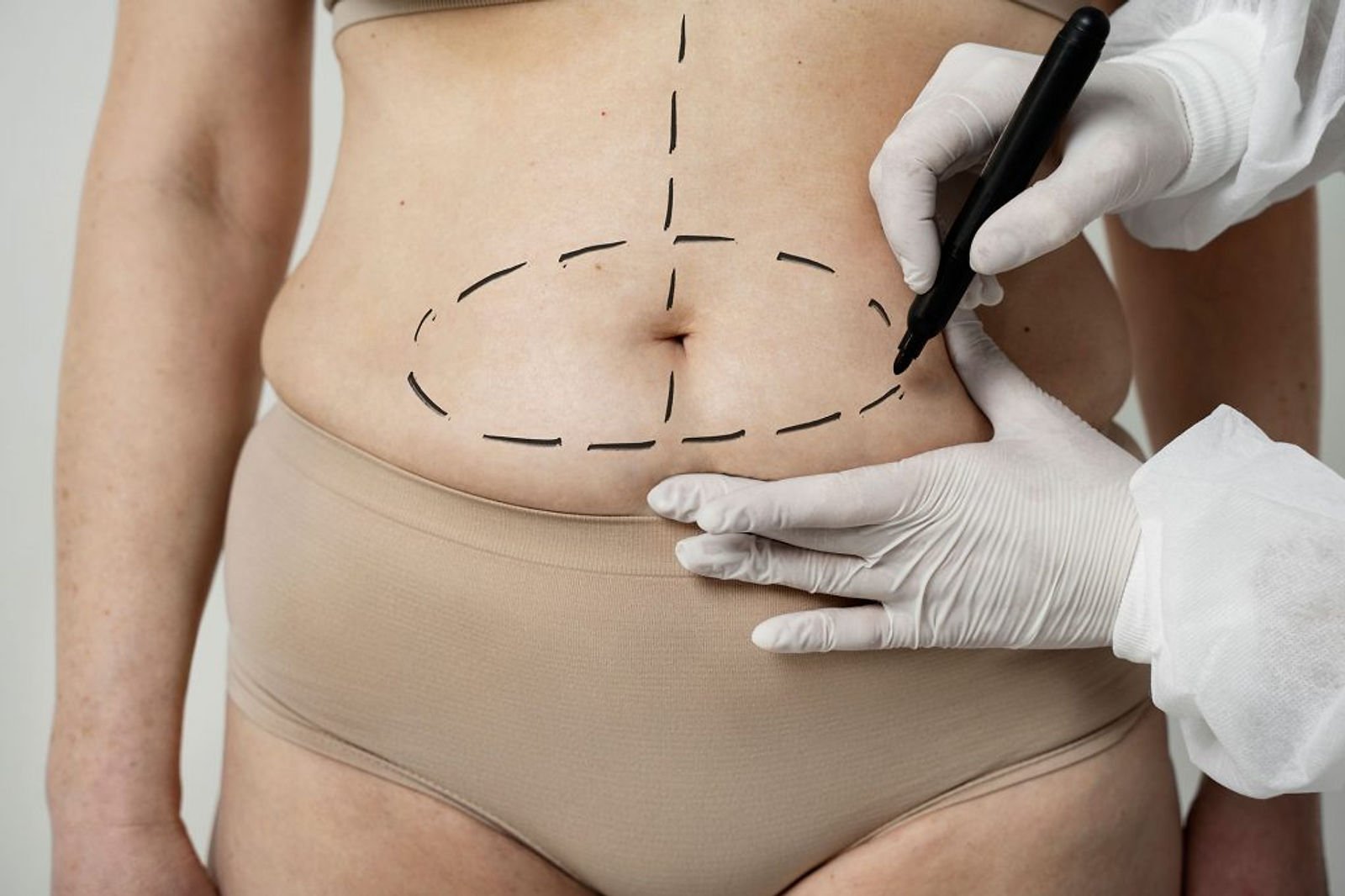Body Surgery